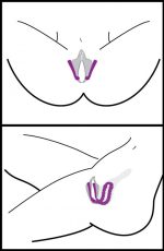 Oral Enhancing Hands Free Labia Spreader - Image 2